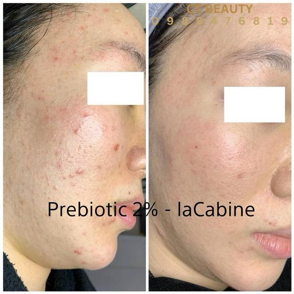 LACABINE 2% PREBIOTIC COMPLEX SERUM CREAM 30 ml